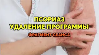 ПСОРИАЗ. Удаление программы. Сеанс энергочистки