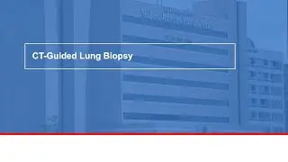 CT-guided lung biopsy