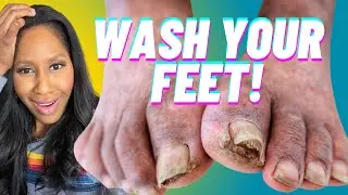 How to WASH YOUR FEET!🦶+How OFTEN to Wash Your Feet! A Doctor Explains