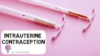 Intrauterine Contraception