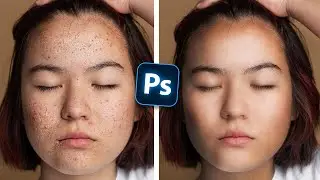 How To FIX YOUR SKIN Like a Pro (Photoshop Tutorial)