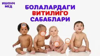 Нима учун болаларда оқ доғлар? Сабаблари! Витилиго