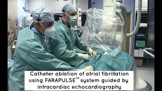 Catheter ablation of atrial fibrillation