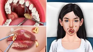 ASMR The best treatment for a girl with swollen lips due, teeth care