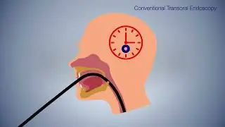 TNE Vs TOE - Olympus Medical