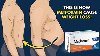 How Does Metformin Cause Weight Loss Unraveling the Science Behind It