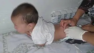 Injection Into The Baby's Buttock. IM INJECTION . Внутримышечный укол детям в ягодицу