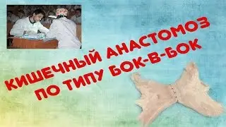 Кишечный анастомоз бок-в-бок