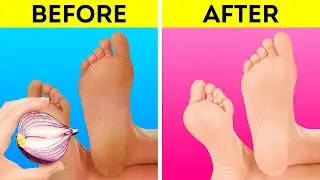 WOW! Genius Foot Care And Shoe Hacks For Your Comfort 🦶🏻👠