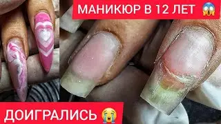 БОЛЯТ ВСЕ НОГТИ 😭 ТРЕЩИНА ПО МЯСУ 🤢МАНИКЮР  В 12ЛЕТ