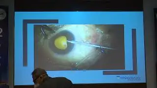 AIOC2022-IC263-When the going gets tough, the tough gets going. Dr Himanshu R Mehta