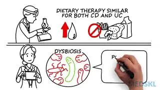 Gastroenterology - Dietary measures to lower inflammation - Whiteboard Video - Barbara Olendzk