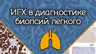 ДЕМО ИГХ биопсий лёгкого | Лекции по патологической анатомии