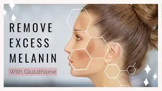 𝄞 Hyperpigmentation Healing ~ Remove Excess Melanin | Skin Lightening | Glutathione ~ Classical