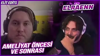 ELRAENN - RRAENEE'NİN AMELİYAT ÖNCESİ VE SONRASI DEĞİŞİMİNE BAKIYOR