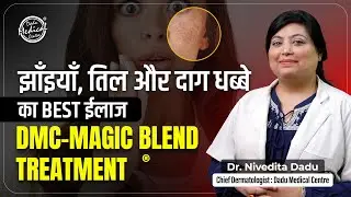 How to Prevent Melasma on face? | Melasma se kaise Chutkara Paye? | Best Treatment for Melasma