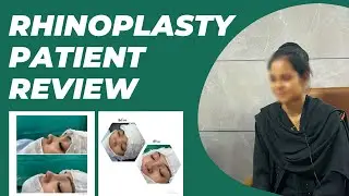 Rhinoplasty Patient Review | Nose Surgery Patient Feedback | Dr Iqbal Ahmed