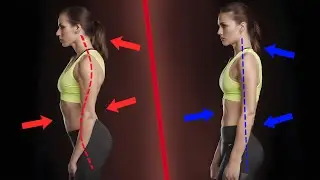 Выпячиваешь попу? ПОПРОЩАЙСЯ С ПОЧКАМИ! / Как убрать гиперлордоз?