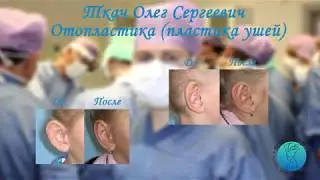 Пластика ушей (отопластика) в Киеве | Otoplasty