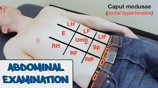 Abdominal Examination - OSCE Guide (old version 2) | UKMLA | CPSA