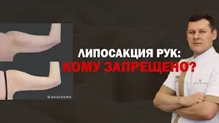 ЛИПОСАКЦИЯ РУК: КОМУ ЗАПРЕЩЕНО❗🔥 ДО ПОСЛЕ