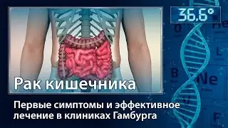 Рак кишечника. Первые симптомы и эффективное лечение в клиниках Гамбурга