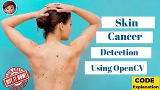 SKIN CANCER DETECTION USING IMAGE PROCESSING PYTHON CODE | TENSORFLOW | LATEST OPENCV PROJECTS 2020