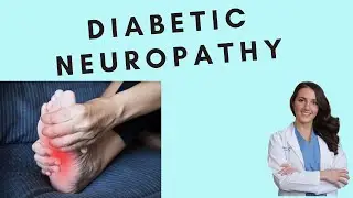 Diabetic Neuropathy. Burning, tingling and numbest. How to treat Diabetic Neuropathy.