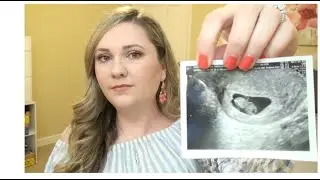 Our Infertility Journey with PCOS | Infertility Awareness | NIAW