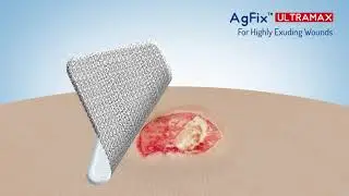 AGFIX Ultra Max Super Absorbent Hydrophilic Foam Silver Pad