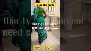 Case of Hip Joint Badly Damaged 🔥 No movement at all |