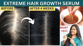 My Mom turned her Thin Hair to Thick Hair in 30 days -Result in 1st Use |Extreme Hair Growth Serum