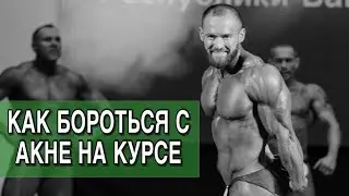 Как бороться с АКНЕ на курсе