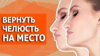 Как ИСПРАВИТЬ мезиальный прикус БЕЗ ОПЕРАЦИИ. Миогимнастика в домашних условиях