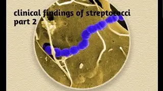 Clinical findings of streptococci | part 2