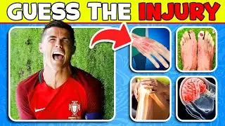 Ronaldo QUIZ ⚡️😱🔥Guess INJURY, Sad Moments of Cristiano Ronaldo? UR Cristiano, Messi, CR7, Neymar