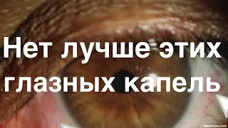 Нет лучше этих глазных капель