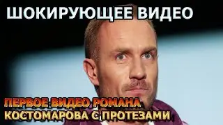 ЭКСКЛЮЗИВНОЕ ВИДЕО! Роман Костомаров показал установленные протезы