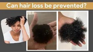 How to Prevent Hair Loss - Tips from a Trichologist #hairloss #hairgrowth