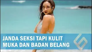 Janda Seksi Tapi Kulit Muka dan Badan Belang, Tampilan Gisel Disorot