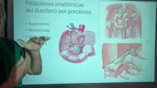 Anatomia Quirurgica del Duodeno, Intestino delgado. Atresia Duodenal. Páncreas anular.