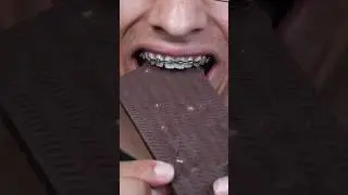 Mr. Beast Bars vs Braces