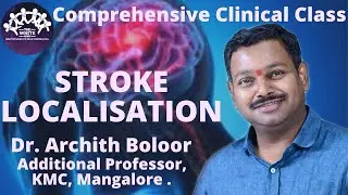 STROKE LOCALIZATION