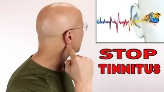 QUIET TINNITUS...5 Simple Acupressure Points!  Dr. Mandell.