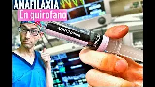 ANAFILAXIA EN EL QUIRÓFANO