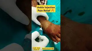 Fast Pain Relief By Ankle Injection 🔥🔥 #anklepainrelief #ankleimpingement #ankleinjury #anklets