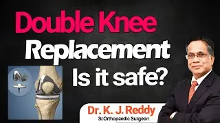 Knee Replacement for both Legs | Dr. K.J Reddy | Sr. Orthopedic Surgeon