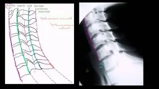 Оценка расположения шейного отдела позвоночника (шеи) на рентгеновских снимках в боковой проекции