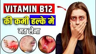 VITAMIN B12 की कमी के लक्षण और उपाय | Signs of Vitamin V12 Deficinecy