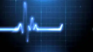 EKG Animation - Free Overlay Stock Footage